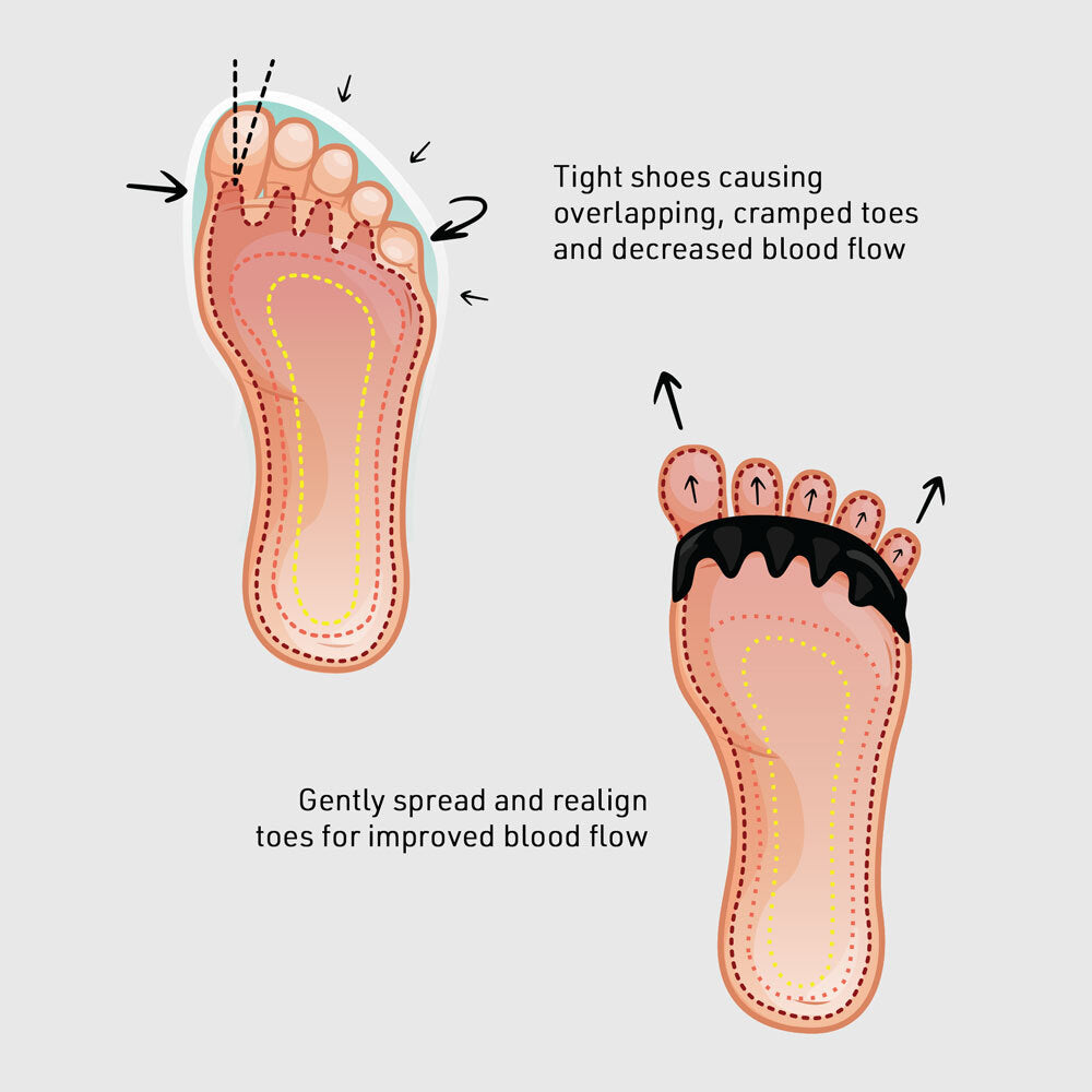 Toe Spreader - Image 7